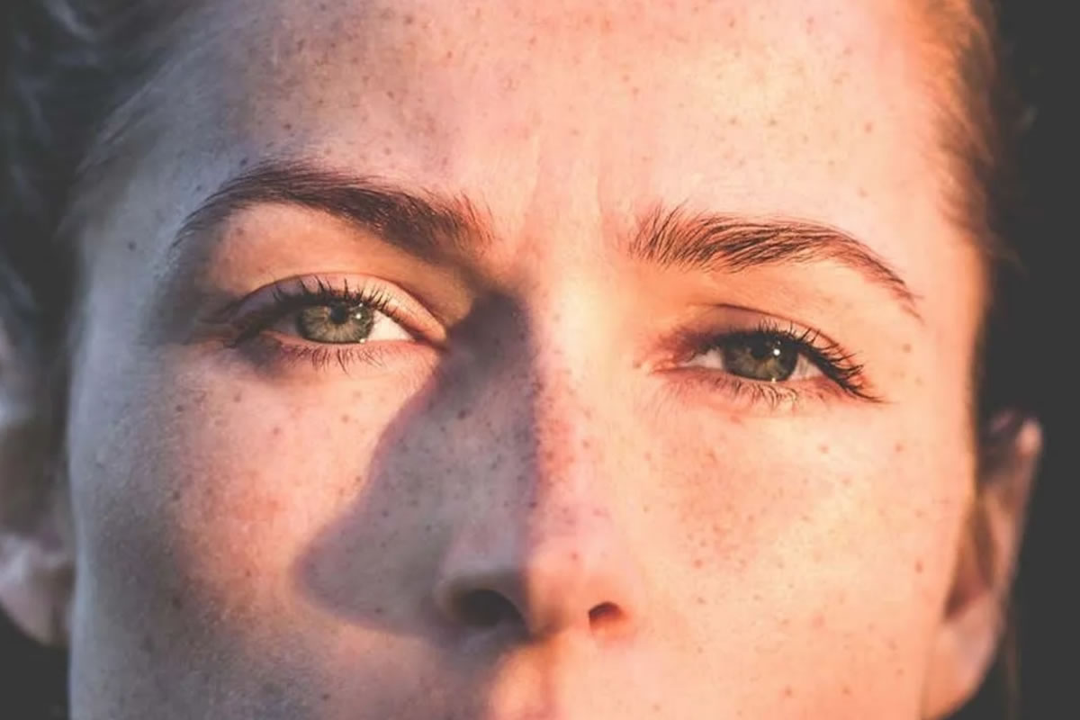 Manchas solares en la piel