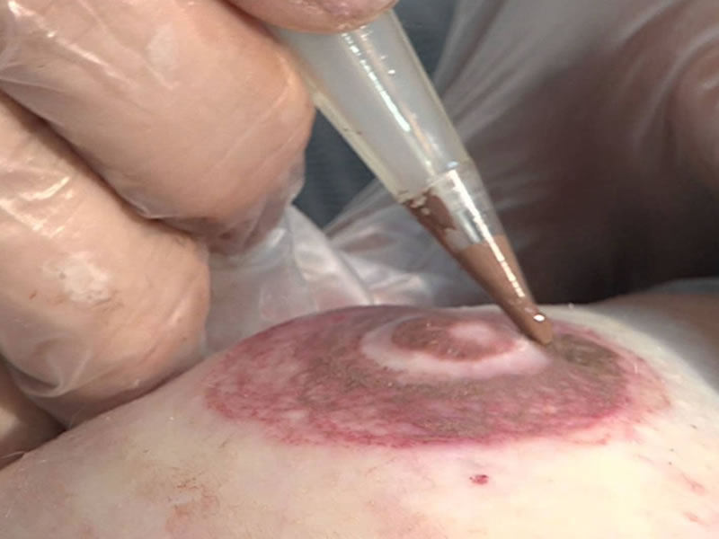micropigmentacion areola