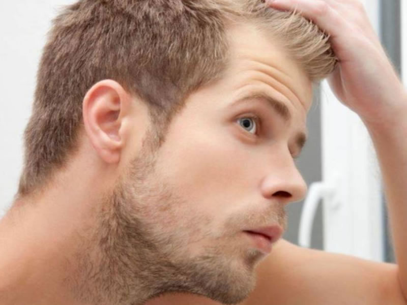 tratamientos contra la caída del cabello