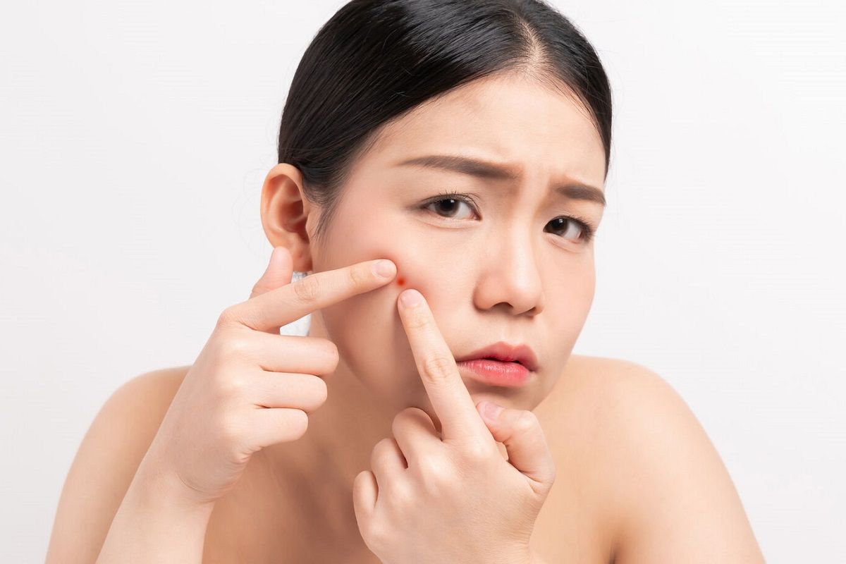 las causas de las espinillas